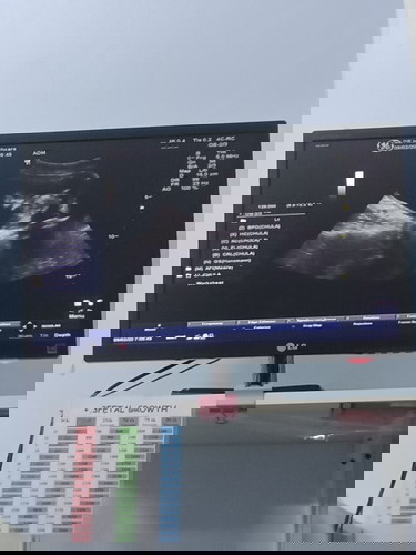 ถ้าตั้งครรภ์ได้5เดิอนนี่คือกี่สัปดาห์หรอค้ะแม่ๆ.?