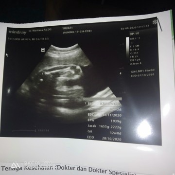 Hasil usg tdi sore