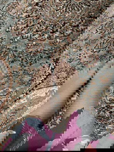 Kaki Bengkak