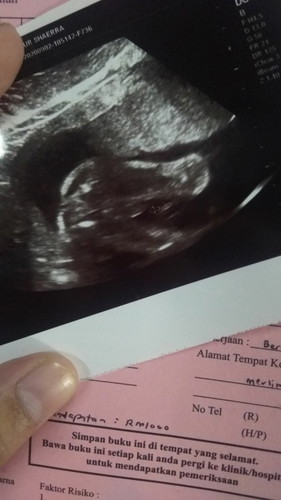 boy or girl