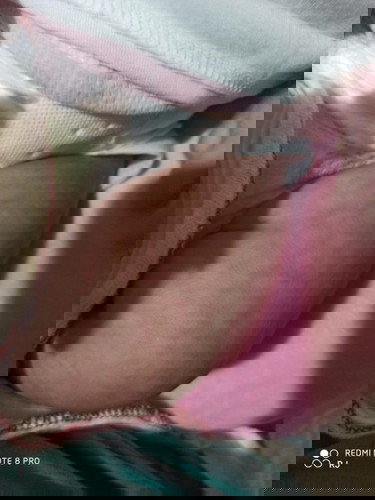 pangingitim ng balat