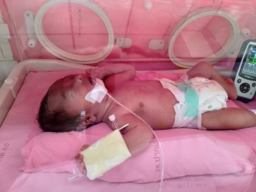 ลูกหายใจเร็ว