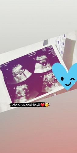 Bahagia pnantian 8 bulan