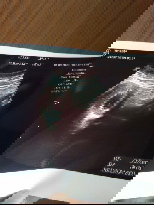 Flek hampir 2 minggu ada yang ngalamin ??