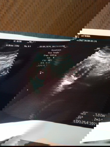 Flek hampir 2 minggu ada yang ngalamin ??