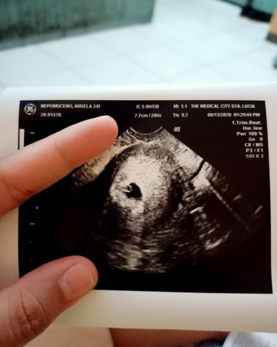 9 weeks and 1st. Time mommy. Any advice po π
