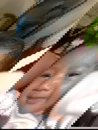 Butlig sa muka ni baby
