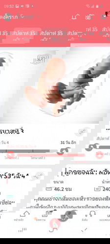แม่ๆๆมีอาการยังไงบ้างค่ะ 35+4