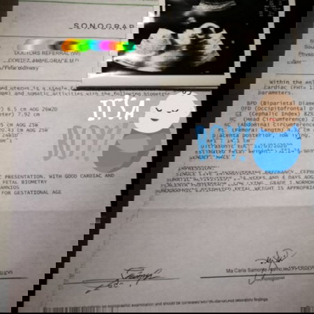 Posterior and Anterior Placenta