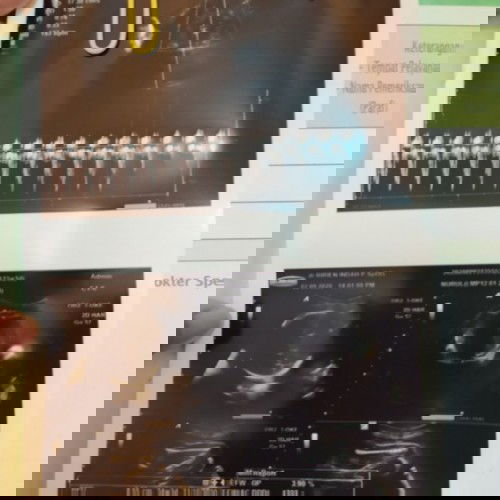 HASIL USG LEBIH CEPAT