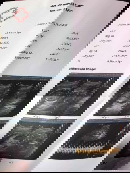 น้ำหลักลูกน้อยไปไหมค่ะ