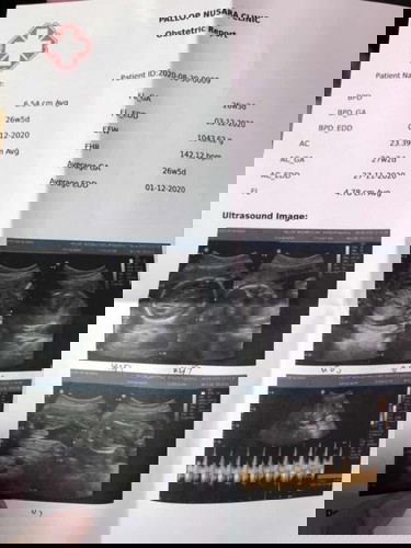 น้ำหลักลูกน้อยไปไหมค่ะ