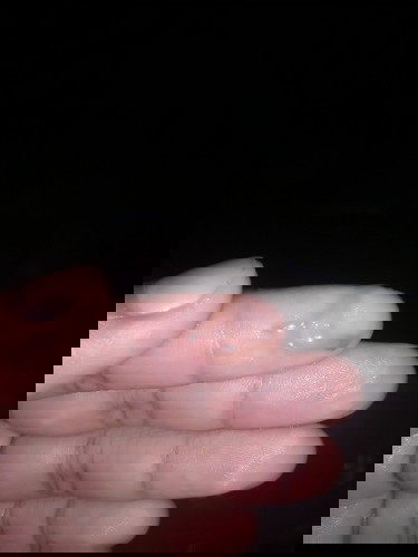 มีมูกสีน้ำตาลออกมา 39+6