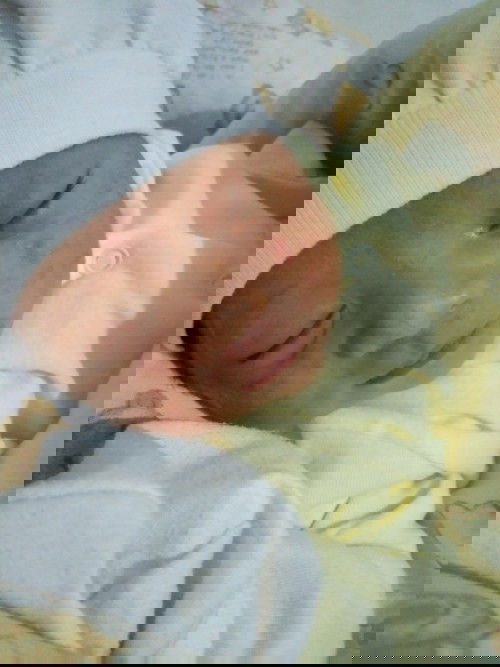 Is it rashes? ir normal?