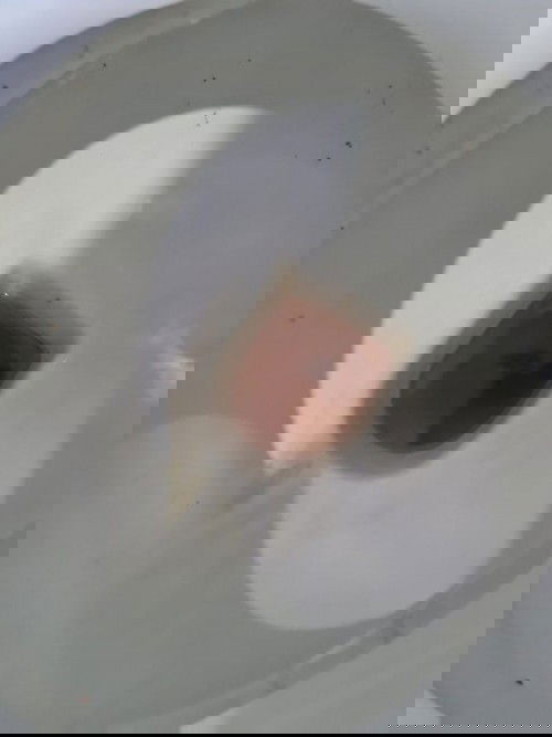 Gumpalan darah seperti ati ayam di kehamilan 8 minggu 3 hari