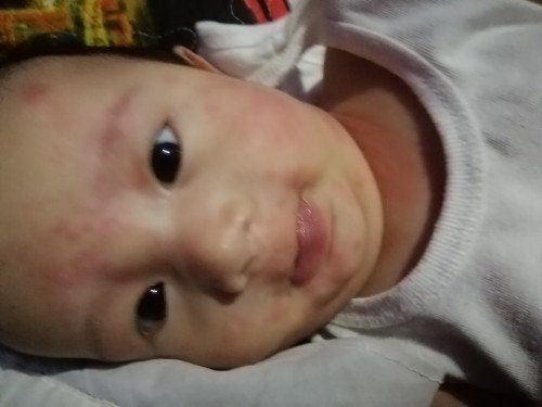 Help naman po baka may na exp kayo gnto kay baby