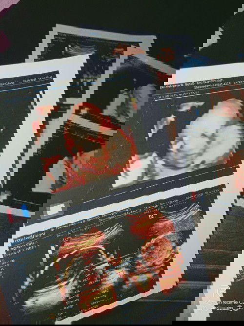 . Pertama kali Usg 💕