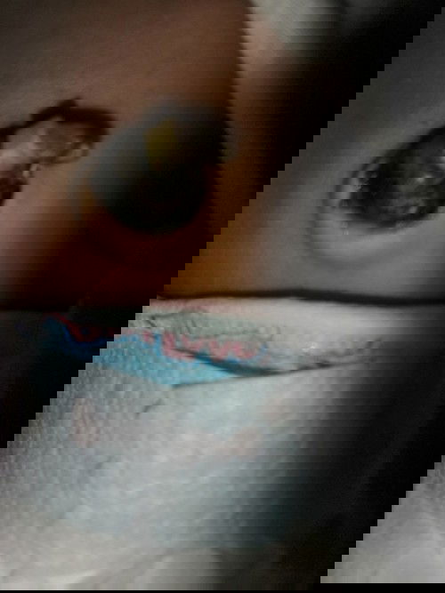 สะดือลูกมีน้ำไหลออกมา