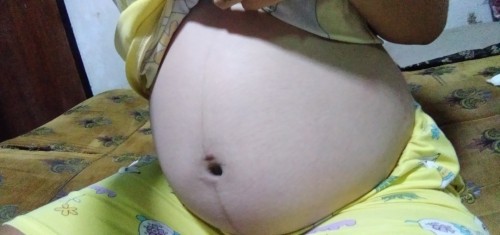 31+2วีค ลูกไม่กลับหัว
