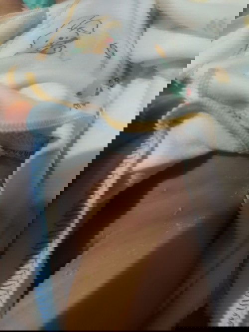 bisul² kecil di perut