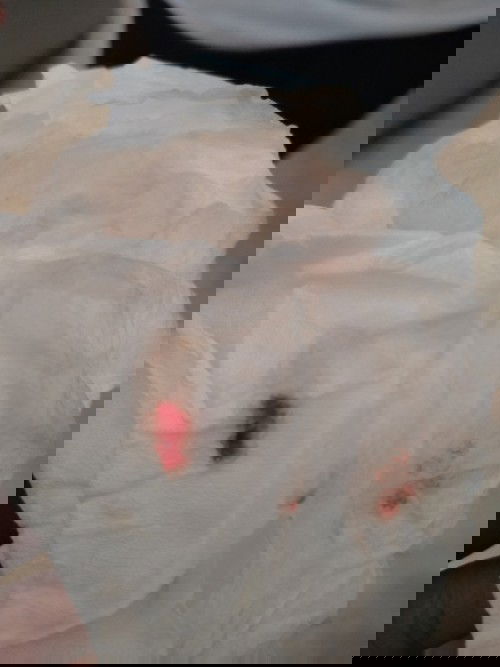 Keluar flek tapi belum kontraksi