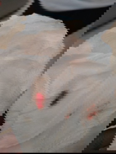 Keluar flek tapi belum kontraksi