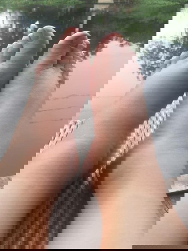 บวมแบบนี้อันตรายมั่ย