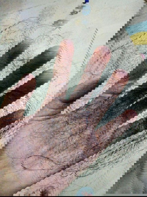 Rambut Rontok selama menyusui