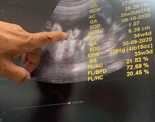 ขอดูรูปอัลตราซาวด์แม่ๆทีมตุลาหน่อยจ้า 🥰