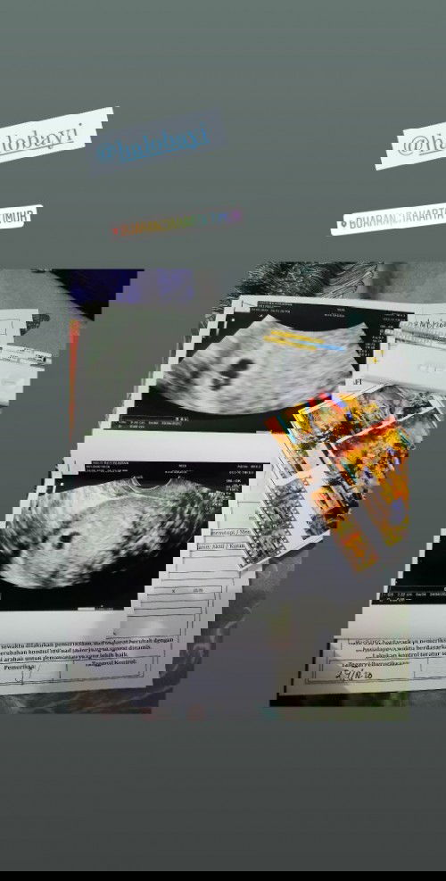 Hamil tidak merasakan mual ngidam