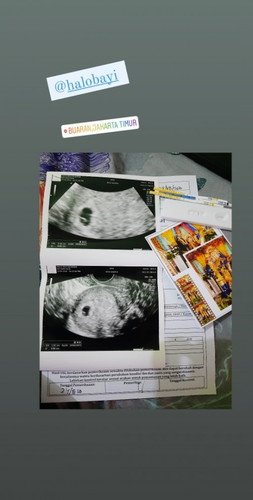 Hamil tidak merasakan mual ngidam