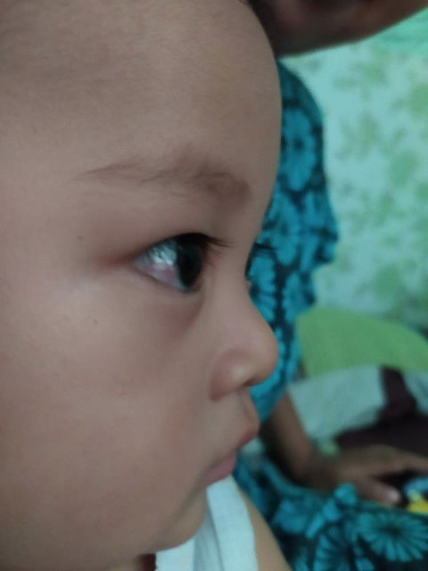 Mata bayi merah