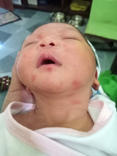 Ano po kaya nasa mukha ng baby ko?