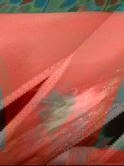 คนตั้งครรภ์