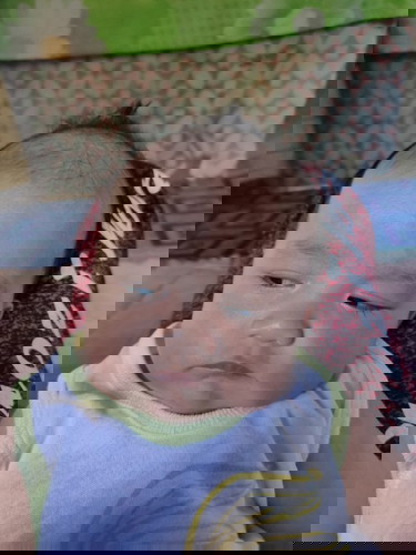 Lumalagas buhok n baby