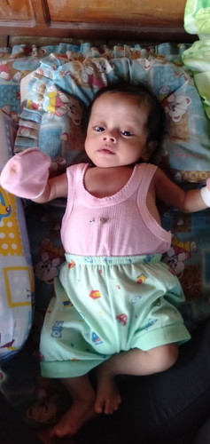 Ada gak bunda yg sama anak sya umur sudah mau masuk 3 bln tapi perkembanganbya lambat