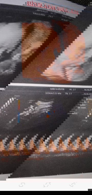 36w bé gái 2900gam