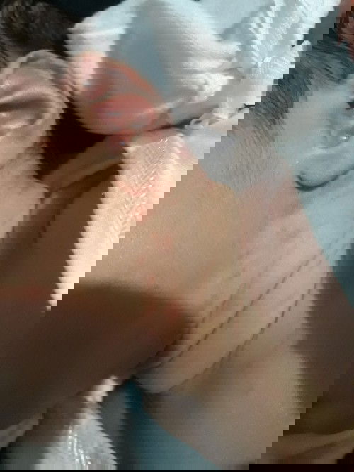 Ano po pwedeng pang gamot