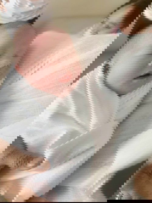 38+5W กำหนดคลอด14กัยยา แตกก่อน