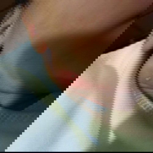 Timbul bintik2 berisi cairan seperti nanah di leher