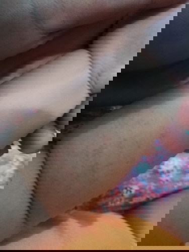 Hello po need help ano po kaya itong nasa braso po ng lo q parang rashes po kulay red sya.. Salamat