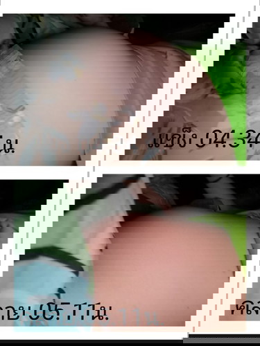 22+6w ท้อง แข็ง