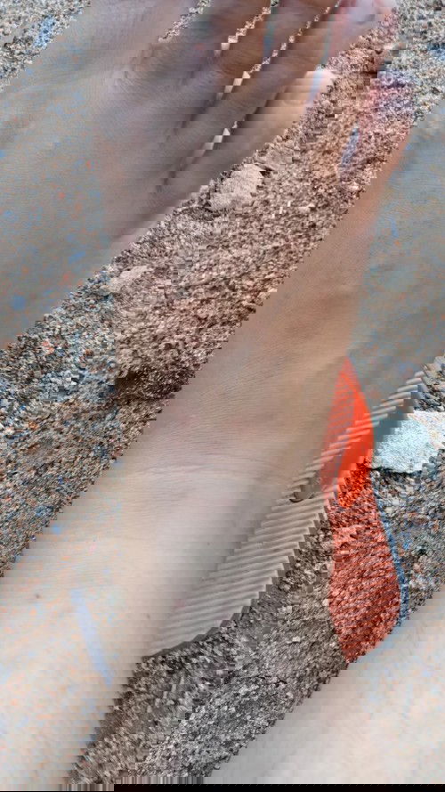 Ruam ruam merah gatal di kaki bumil