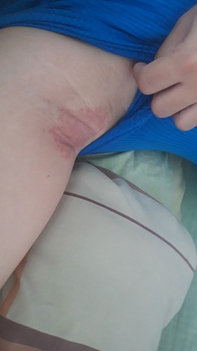 ทำไงดีรักษายังไงดีคะ