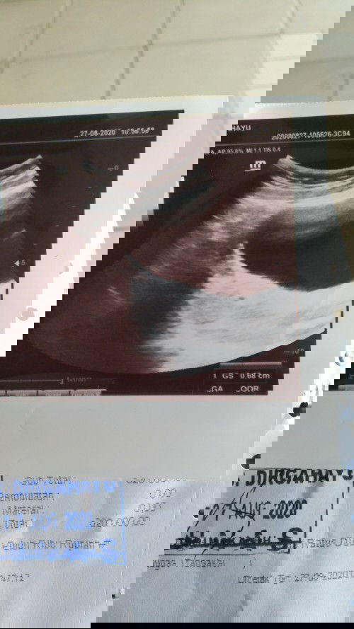 1. usia 6 Minggu 3 hari