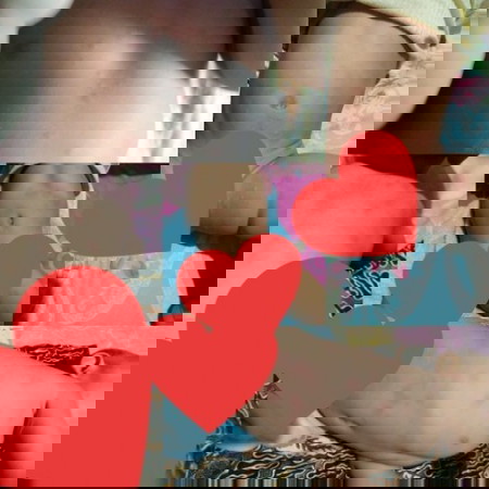 alergi pada bayi