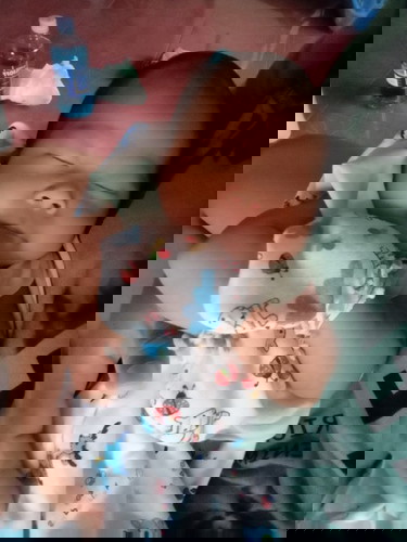 คลอดก่อนกำหนด