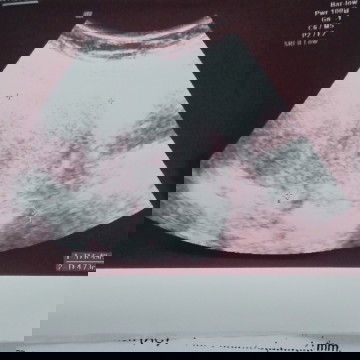 Bunda2 cantik sya mau tanya