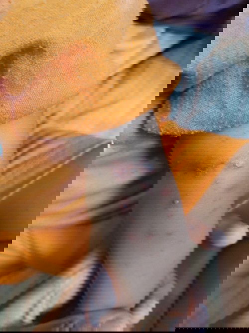 Kalo anak bunda ada yg ngalamin seperti anak aku, minta solusinya bun