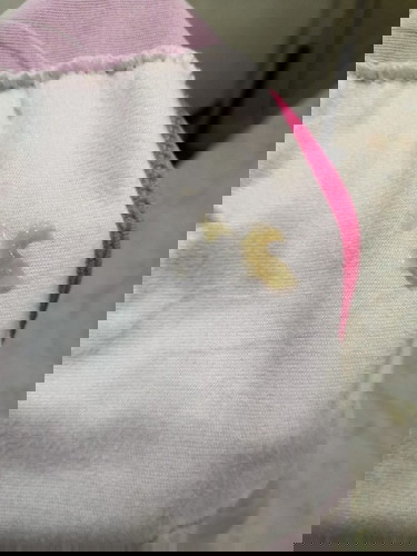 PASINTABI PO MGA MOMSH ANU PO KEA TO LUMABAS SKIN KNINA?MUCUS PLUG PO BA?